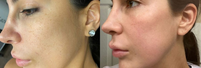 spectrum before after II