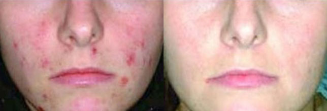 spectrum before after